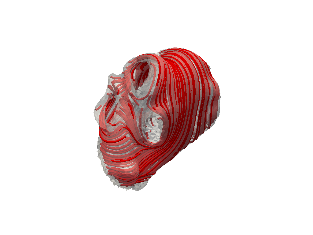 compute atrial fibers pr