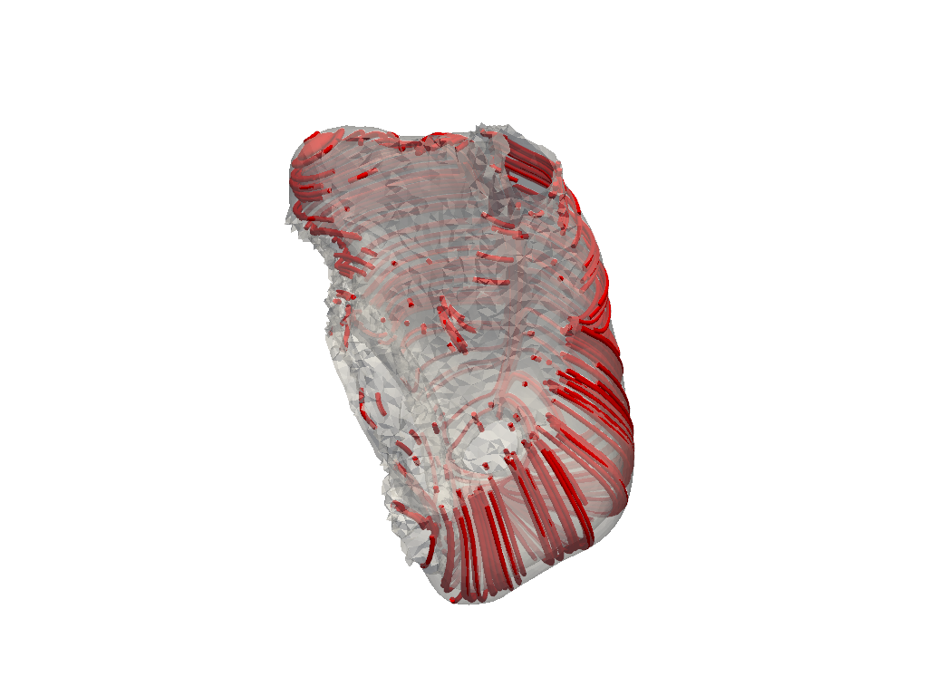 compute atrial fibers pr