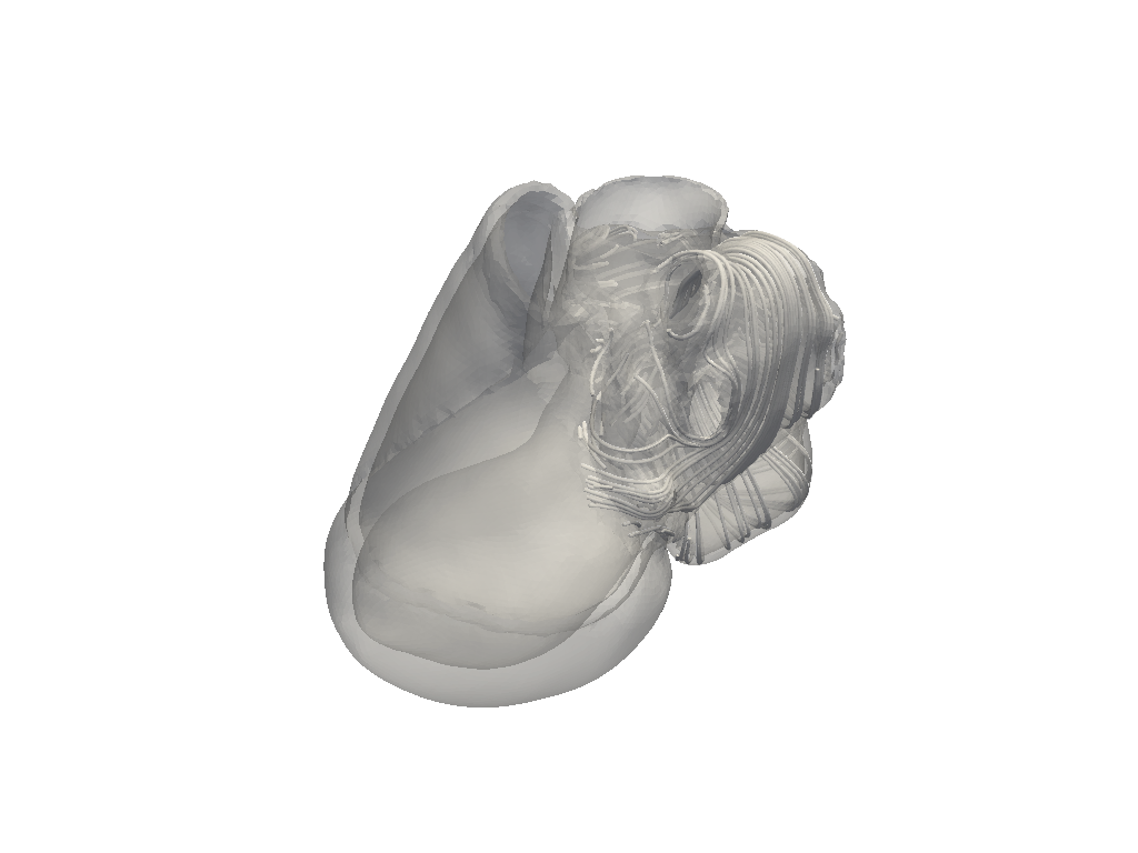 compute atrial fibers pr